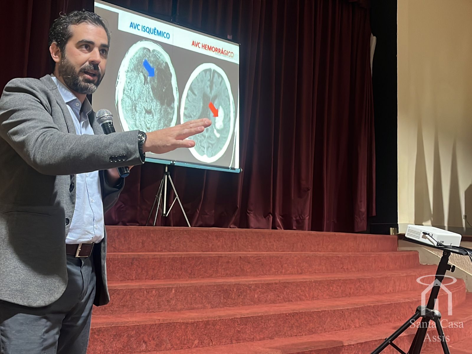 Santa Casa de Assis promove capacitação sobre atendimento ao AVC na fase aguda